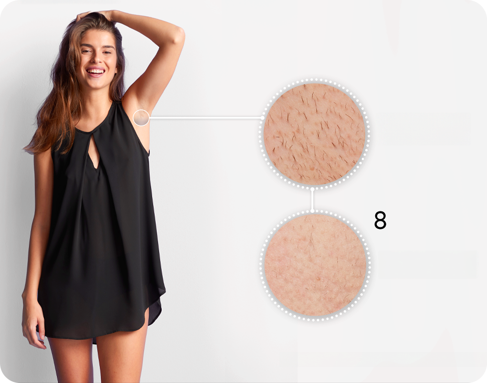 IPL epilátor Braun IPL Skin I·Expert PL7257 + pouzdro a 3 hlavy