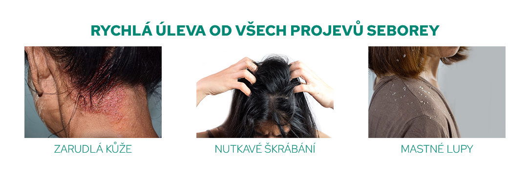 Šampon CANNADERM Capillus Seborea Shampoo 150 ml