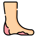 Medications for Fungal Skin Infections & Ulcers