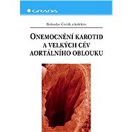 Diseases of the carotid arteries and great vessels of the aortic arch - Bohuslav Čertík
