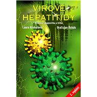 Virové hepatitidy - Laura Krekulová