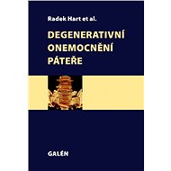 Degenerative spine disease - Radek Hart