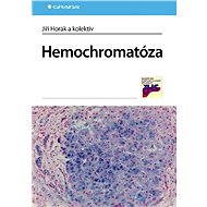 Haemochromatosis - Jiří Horák