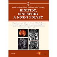 Rinitidy, sinusitidy a nosní polypy - MUDr. Bohumil Markalous