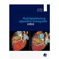 Multidetektorová výpočetní tomografie srdce - Jan Baxa