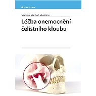 Treatment of temporomandibular joint disease - kolektiv a