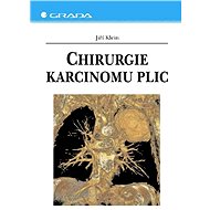 Surgery for lung cancer - Jiří Klein