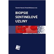 Biopsie sentinelové uzliny - Čestmír Neoral