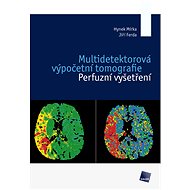 Multidetektorová výpočetní tomografie  - Jiří Ferda