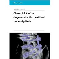 Surgical treatment of degenerative disorders of the lumbar spine - Jiří Šrámek