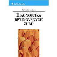 Diagnosis of retinated teeth - Pavlína Černochová