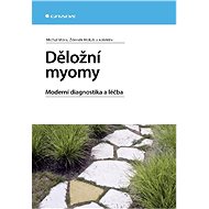 Uterine fibroids - Michal Mára