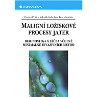 Malignant lesional processes of the liver - Zdeněk Kala
