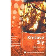 Křečové žíly - MUDr. Petr Lepší