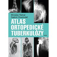 Atlas of orthopaedic tuberculosis - Dalimil Chocholáč  Miroslav Netval