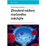Malignant tumours of the bladder - kolektiv a