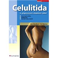 Celulitida - Alice Schmidtová