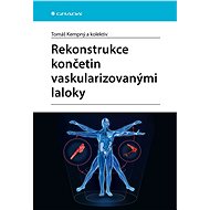 Limb reconstruction with vascularised flaps - kolektiv a
