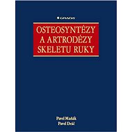 Osteosynthesis and arthrodesis of the hand skeleton - Pavel Maňák