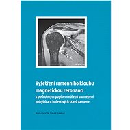 Vyšetření ramenního kloubu magnetickou rezonancí s podrobným popisem nálezů u omezení pohybů u boles - Boris Pauček