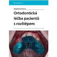 Orthodontic treatment of cleft patients - Magdalena Koťová