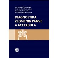 Diagnostika zlomenin pánve a acetabula - Jana Chmelová