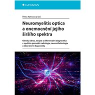 Neuromyelitis optica and disorders of its broader spectrum - kolektiv a