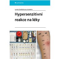 Hypersensitivity reactions to medications - kolektiv a