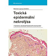 Toxic epidermal necrolysis - kolektiv a