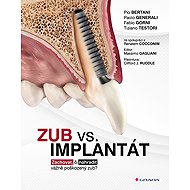 Tooth vs. implant - kolektiv a