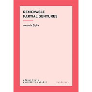 Removable Partial Dentures - Antonín Zicha