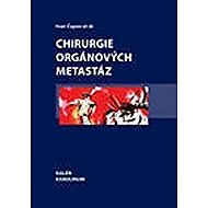 Chirurgie orgánových metastáz - Ivan Čapov