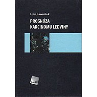 Prognóza karcinomu ledviny - Ivan Kawaciuk