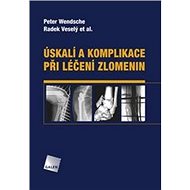 Úskalí a komplikace při léčení zlomenin - Peter Wendsche; Radek Veselý