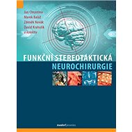 Funkční stereotaktická neurochirurgie - Jan Chrastina; Marek Baláž; Zdeněk Novák