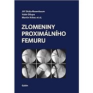 Zlomeniny proximálního femuru - Jiří Skála-Rosenbaum; Valér Džupa; Martin Krbec