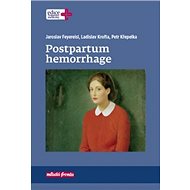 Postpartum hemorrhage - Jaroslav Feyereisl; Ladislav Krofta; Petr Křepelka