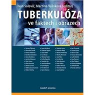 Tuberkulóza ve faktech i obrazech - Ivan Solovič