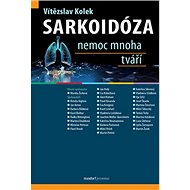 Sarkoidóza Nemoc mnoha tváří - Vítězslav Kolek