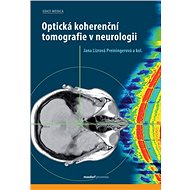 Optická koherenční tomografie v neurologii - Jana Lízrová Preiningerová