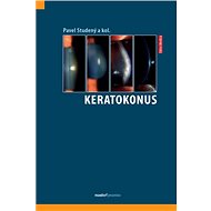 Keratokonus - Pavel Studený