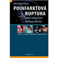 Poinfarktová ruptura - 