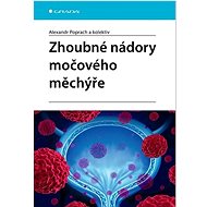 Zhoubné nádory močového měchýře - Alexandr Poprach