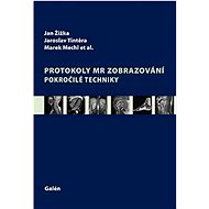Protokoly v MR zobrazování: Pokročilé techniky - Jan Žižka; Marek Mechl; Jaroslav Tintěra