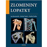 Zlomeniny lopatky - Jan Bartoníček; Michal Tuček; Ondřej Naňka