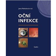 Oční infekce - Jana Nekolová