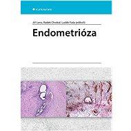Endometrióza - Lenz Jiří; Chvátal Radek; Luděk Fiala