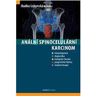 Anální spinocelulární karcinom  - Radka Lohynská