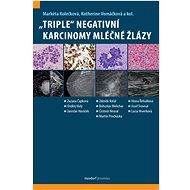 „Triple“ negativní karcinomy mléčné žlázy - Markéta Kolečková; Katherine Vomáčková