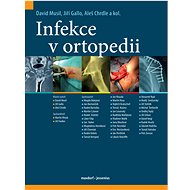 Infekce v ortopedii - David Musil; Jiří Gallo; Aleš Chrdle